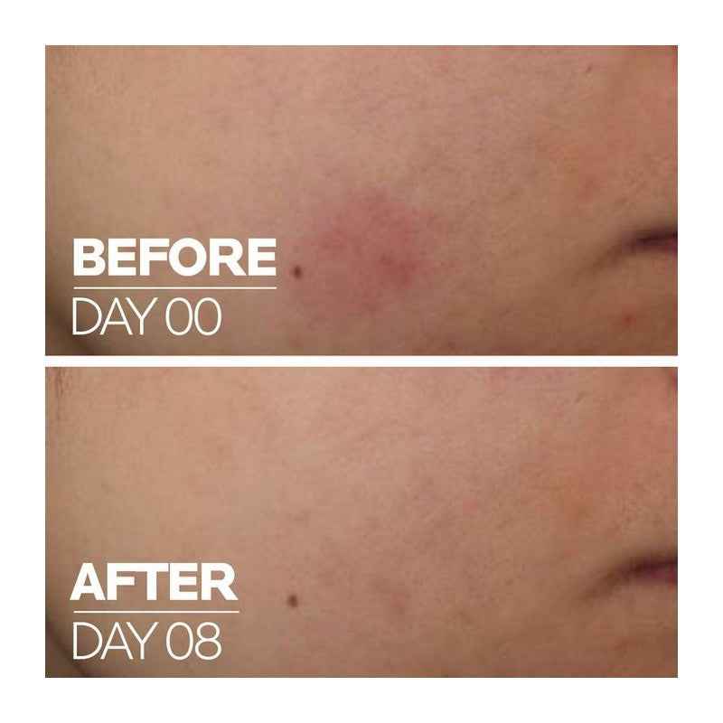 LA ROCHE POSAY CICAPLAST B5 SERUM ULTRA REPARADOR