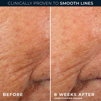 ROC RETINOL SMOOTHING NIGHT SERUM 30 CAP