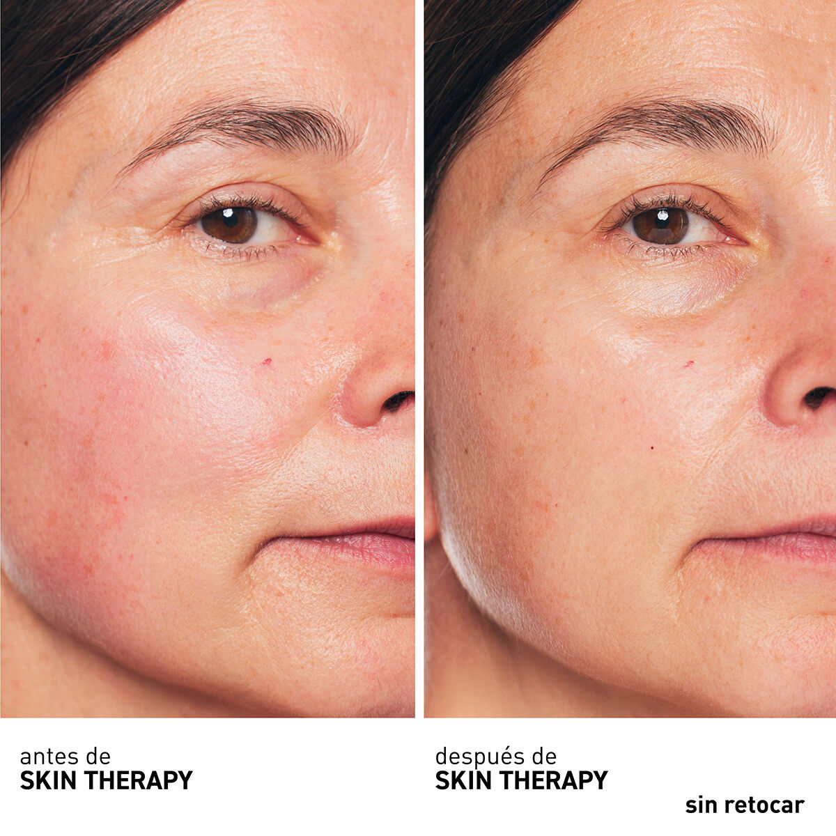ERBORIAN SKIN THERAPY OIL 30 ML