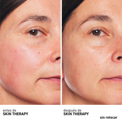 ERBORIAN SKIN THERAPY OIL 30 ML