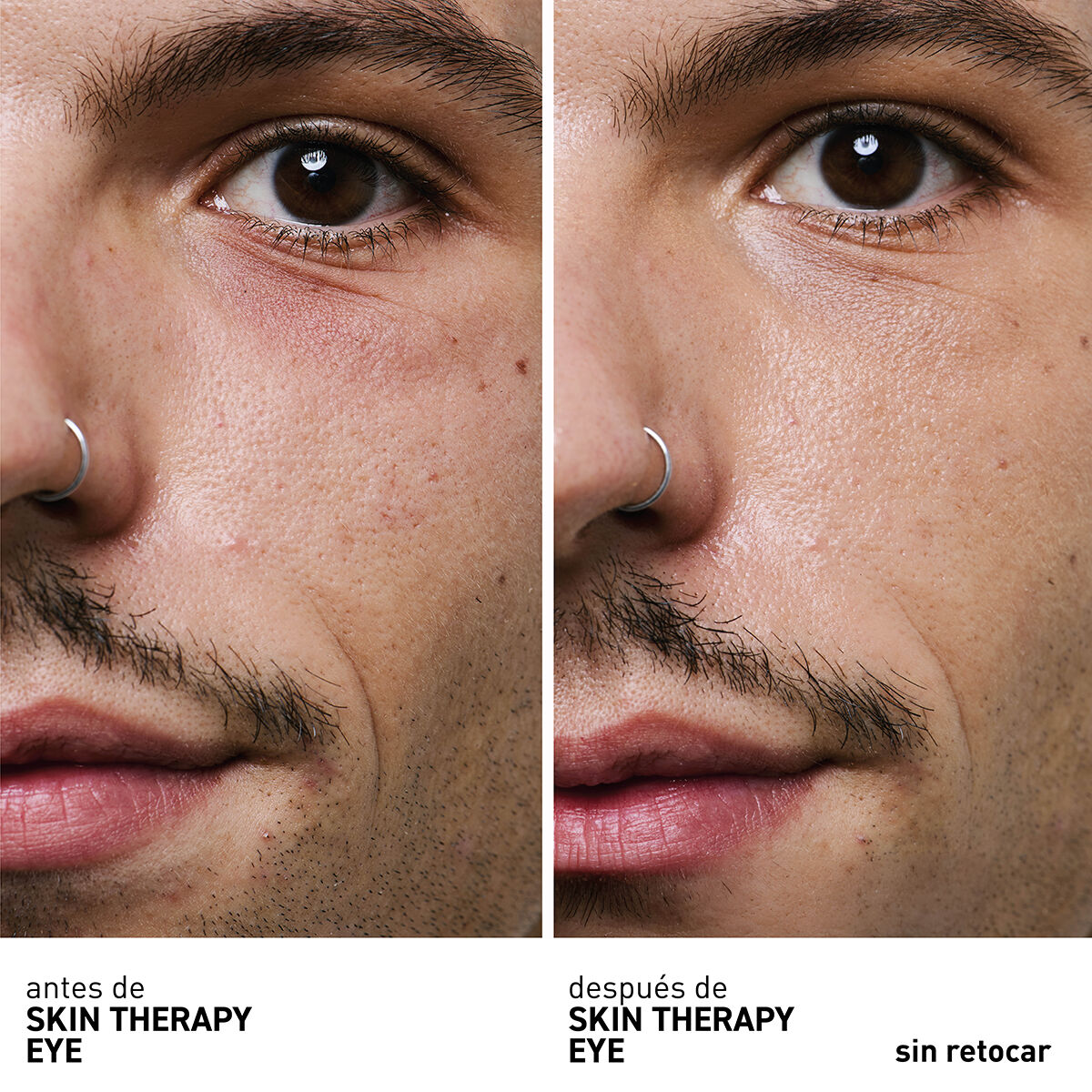 ERBORIAN SKIN THERAPY EYE 15 ML