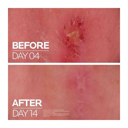 LA ROCHE POSAY CICAPLAST BAUME 5% CREMA 40 ML