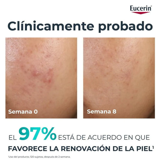 EUCERIN DERMOPURE PEELING 10 40 ML