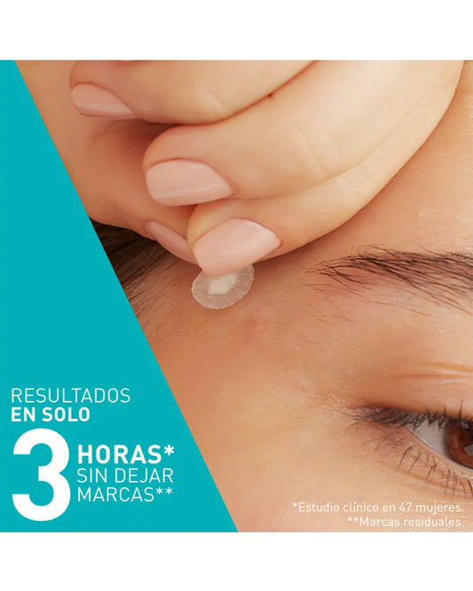 PARCHES CONTROL ANTIIMPERFECCIONES CERAVE