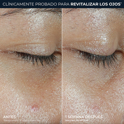 ROC REVIVE SKINCARE STICK CONTORNO DE OJOS VITAMINA C +PEPTIDOS 4G