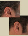 CUBRE CANAS MORENO FARMA DORSCH